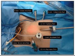 Robot Assisted Radical Prostatectomy How I Do It Part I Patient