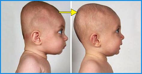 7 Helpful Tips To Prevent Flat Head In Babies Flat Head Baby 2 Month