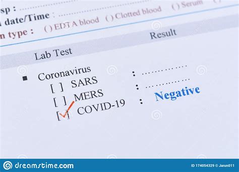 Results same day by 10 pm, if swabbed before 11 am. Negative Test Result Of COVID-19 Stock Image - Image of ...
