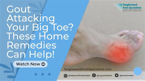 Gout Attacking Your Big Toe These Home Remedies Can Help Youtube