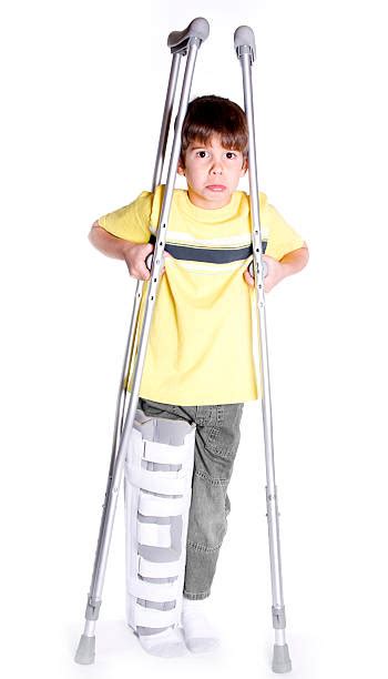 Child Broken Leg Stock Photos Pictures And Royalty Free Images Istock