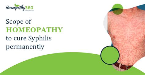 Scope Of Homeopathy To Cure Syphilis Permanently
