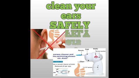 Excess ear wax is not uncommon. How to clean your ears safely!!! - YouTube
