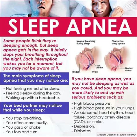 what you should know about sleep apnea sleep apnea remedies what causes sleep apnea sleep apnea