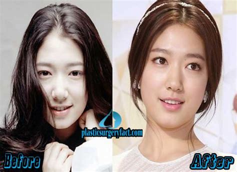 Park Shin Hye Before And After