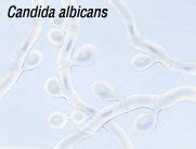 Candidiasis Guide Causes Symptoms And Treatment Options