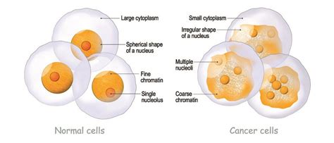 Cancer Cells Vs Normal Cells Microscope