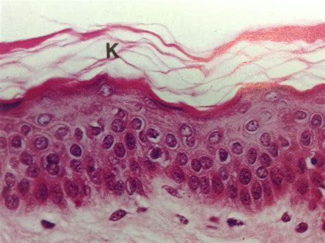 Epit Lio Pavimentoso Estratificado Queratinizado Modisedu