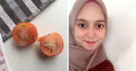 Untuk bekas jerawat karena hiperpigmentasi, anda dapat menggunakan krim untuk mengatasinya. Hanya Guna Tomato Beku, Bantu Hilangkan Jerawat & Parut ...