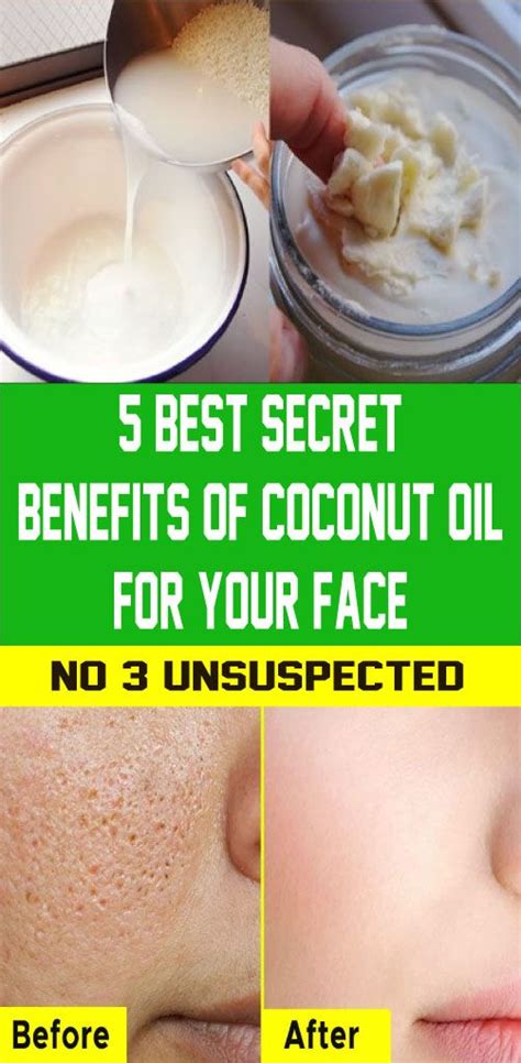 5 Best The Benefits Of Coconut Oil For Your Face That You Have Missed