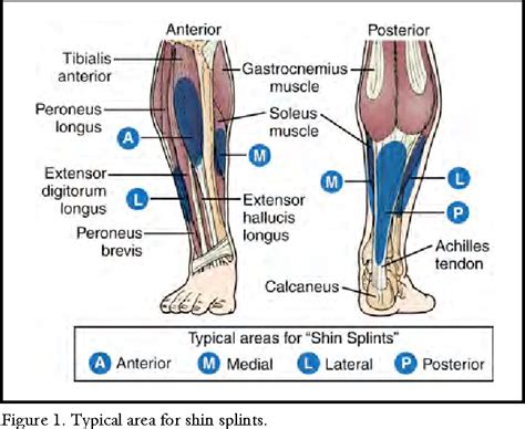 Figure 1 From Medial Tibial Stress Syndrome Semantic Scholar