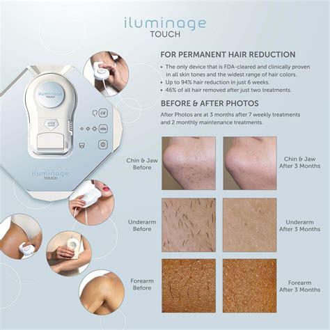 iluminage touch permanent hair reduction system hair reduction iluminage intense pulsed light