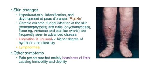 Lymphedema