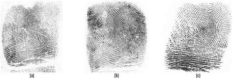 Fingerprints In Identical Twins Why They Are Different Twinfo