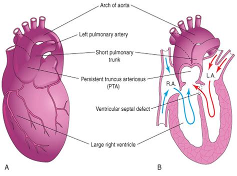 Mbbs Medicine Humanity First Cardiovascular Embryology