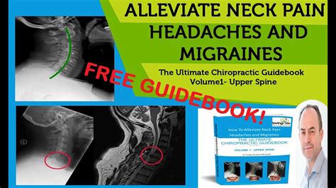 How To Alleviate Neck Pain Headaches And Migraines The Ultimate