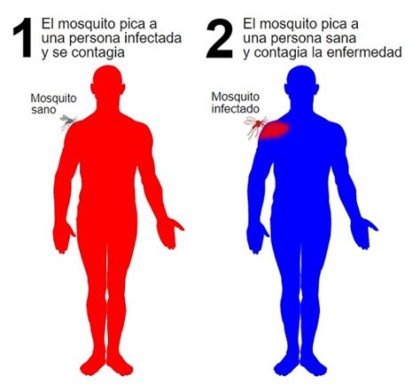 🥇【 ¿quÉ Es El Dengue 】 ️ Síntomas Tratamiento Prevención