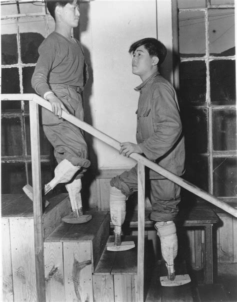 Historicaltimessoldiers Learning To Walk Again With Artificial Limbs