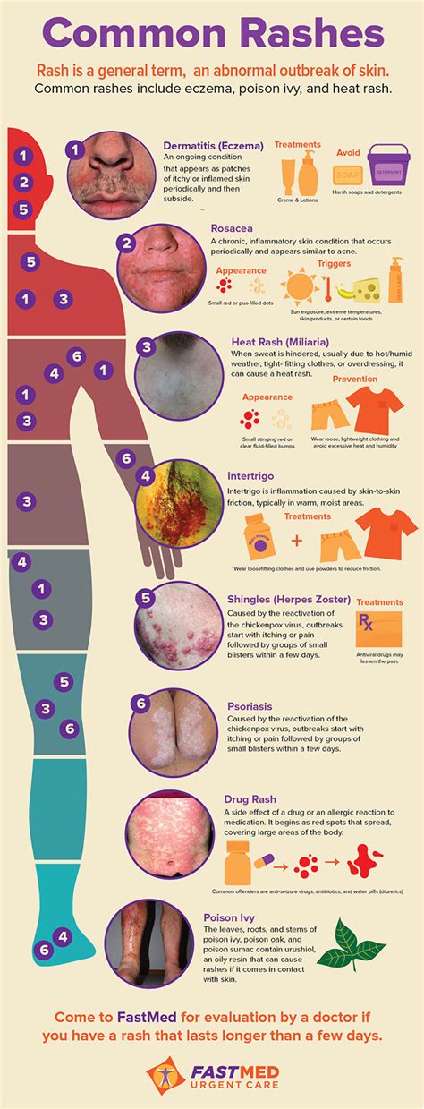 Common Rashes Infographic Fastmed