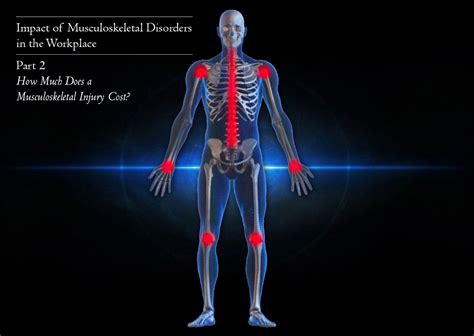 Musculoskeletal Disorders What Are They Costing You