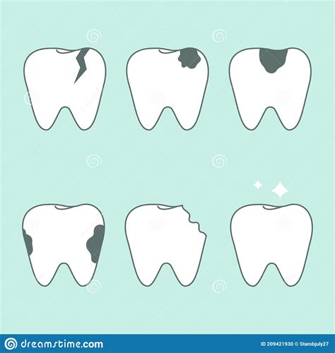 Set Of Healthy And Unhealthy Teeth Stock Illustration Illustration Of