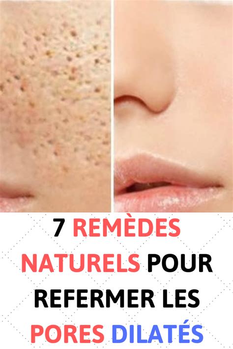 7 Remèdes Naturels Pour Refermer Les Pores Dilatés Avec Images