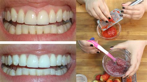 Ingredients To Make Teeth Whiter Moms Smile