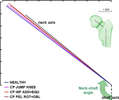 Growth Trajectory Of The 2d Femoral Neck Shaft Angle In Black The