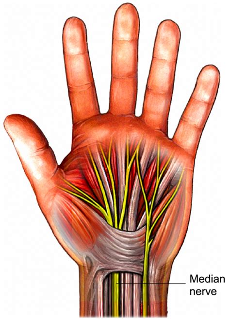 Carpal Tunnel Syndrome Hand Therapy Human Anatomy And