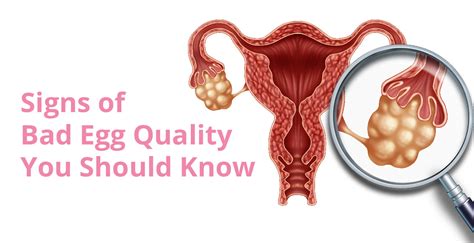 What Are The Signs Of Bad Egg Quality Birla Fertility And Ivf