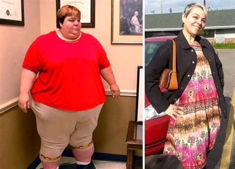 Amazing Before And After Photos Of Fat People Who Slimmed Down