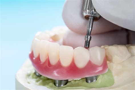 Proteze Dentare Cabinet Stomatologic Dentplus