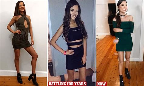 Jade Wright Guy Who Lost Ten Years Of Her Life To Anorexia Shares How