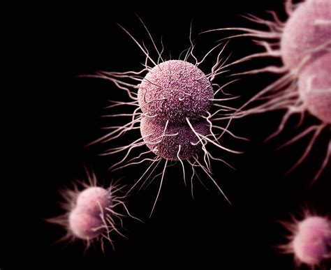 About 1 in 10 infected men and 5 in 10 infected women will not experience any obvious symptoms. Gonorrhea May Become Untreatable, CDC Warns | The Science ...