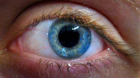 Doctors Find 27 Contact Lenses Hidden In 67 Year Old Womans Eye Bt