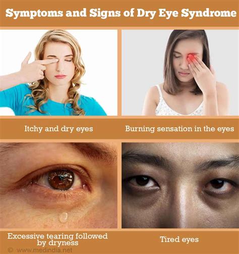 Symptoms And Signs Of Dry Eye Syndrome