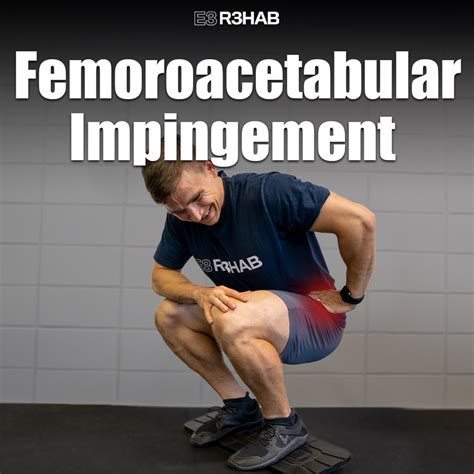 Femoroacetabular Impingement E3 Rehab