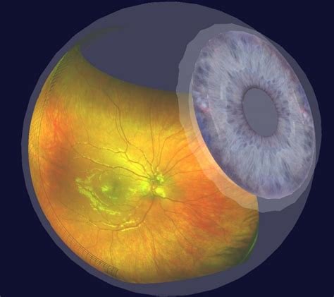Digital Retinal Examination 2 Haven Opticals Limited
