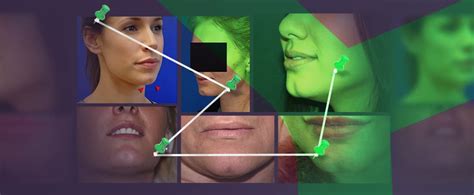 What Causes A Cleft Chin According To Science Ach