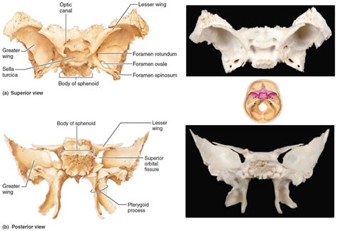 Sphenoid Bone Anatomy Function Parts And Sphenoid Bone Fracture