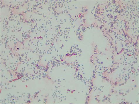 Micrograph Bacillus Subtilis D Endospore X P Oer Commons