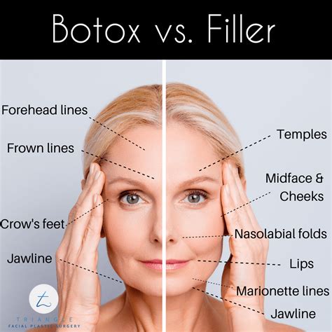 Whats The Difference Between Botox And Fillers Botox And Its Newer
