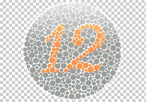 Color Blindness Ishihara Test Vision Loss Visual Perception Color Vision Png Clipart