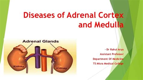 Diseases Of Adrenal Cortex And Medulla