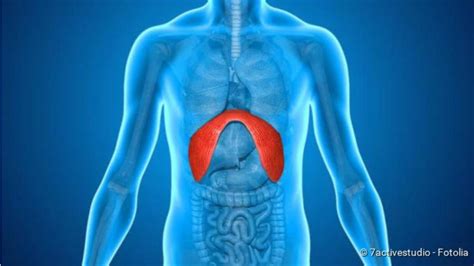 Diaphragmatic Hernia Causes Symptoms Treatment Medical Society