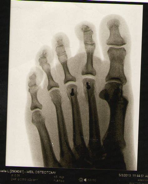 Gambar Tangan Kaki Lengan Tulang Tubuh Manusia Sketsa Gambar Kerangka Anatomi Organ