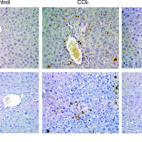 Immunohistochemical Staining Of Liver Sections For Tgf B And F480