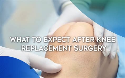 What To Expect After Knee Replacement Surgery Io Core