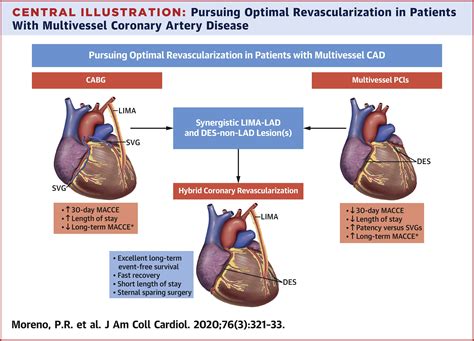 The Hybrid Coronary Approach For Optimal Revascularization Jacc Review
