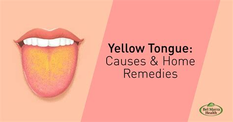 10 Common Causes And Treatments For Yellow Tongue